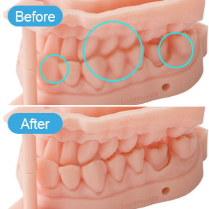 uv resin curing light
