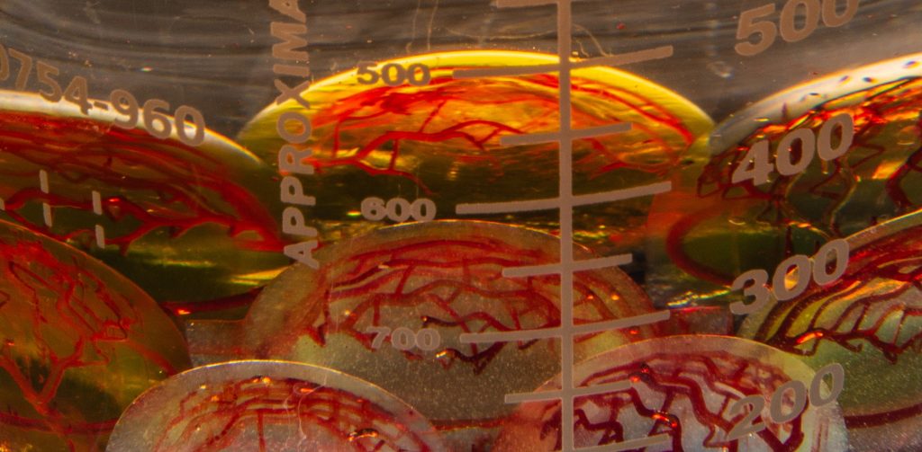  CollPlant previously worked with 3D Systems to bioprint many tissue scaffolds