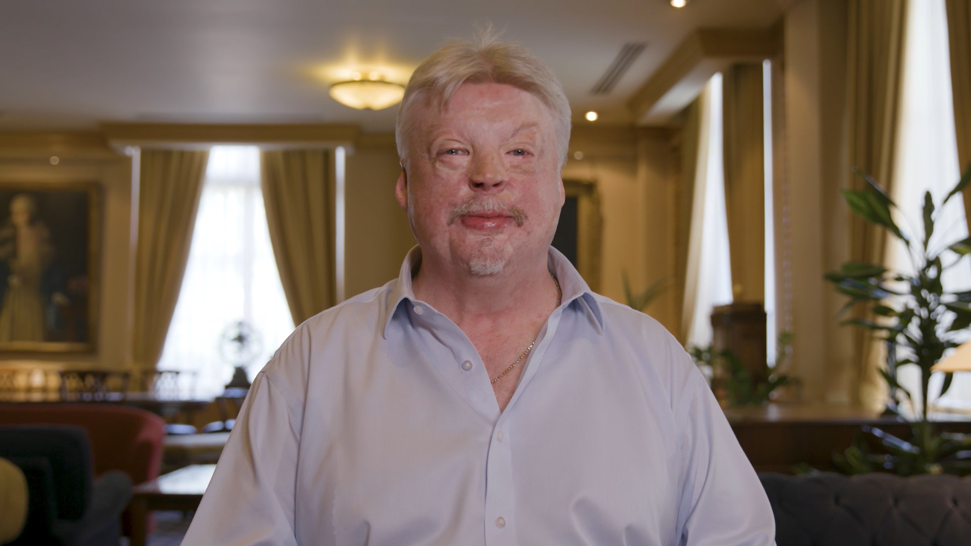 Simon Weston CBE, Chief Ambassador of Unscarred Foundation  Simon Weston CBE, Chief Ambassador of Unscarred Foundation