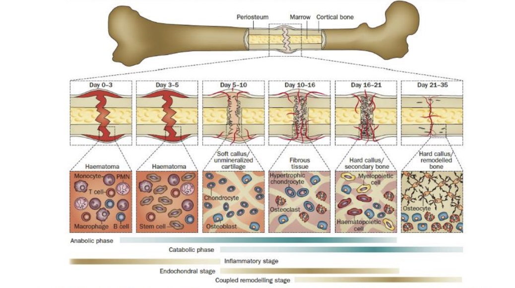 The healing process of bones after fracture trauma.Days 0 to 5 represent the inflammatory phase, days 5 to 16 represent the repair phase, and days 16 to 35 represent the remodeling phase