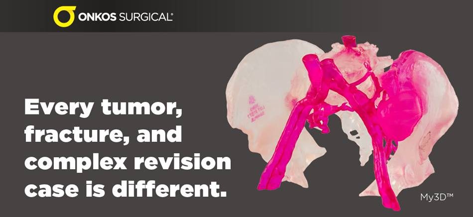 Onkos Surgical My3D™ personalized solution platform
