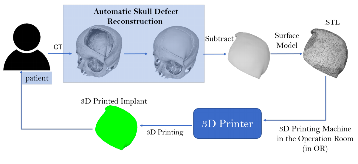 The research team’s new automated procedure allows manufacturing and design to be performed entirely in the same hospital as the patient The research team’s new automated procedure allows manufacturing and design to be performed entirely in the same hospital as the patient