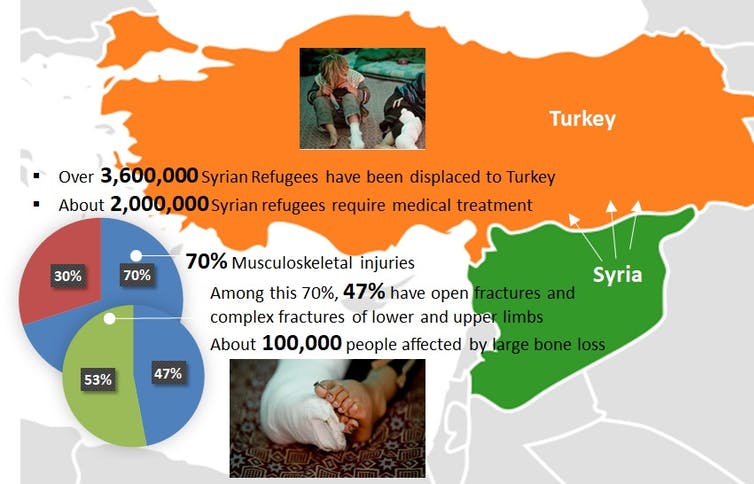 Infographic of refugees in Syria in Turkey Infographic of refugees in Syria in Turkey