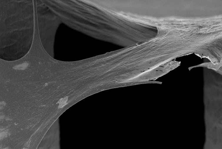 Bone bricks at x750 magnification Bone bricks at x750 magnification