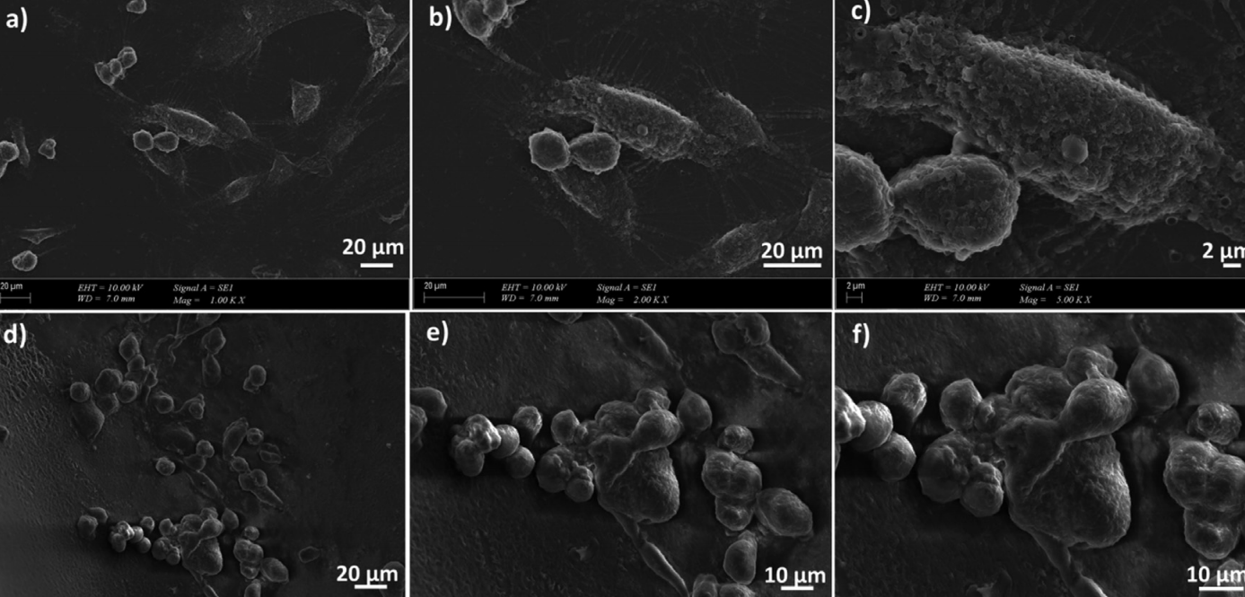  Seven days later, SEM imaging of the differentiated stem cells