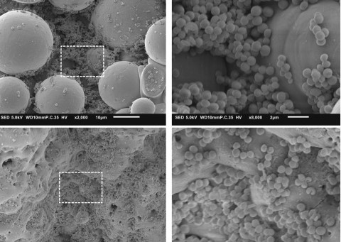 SEM imaging of bacterial clusters on the implant