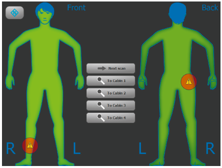 Non-contact millimeter wave security detector, a powerful weapon for new coronavirus detection