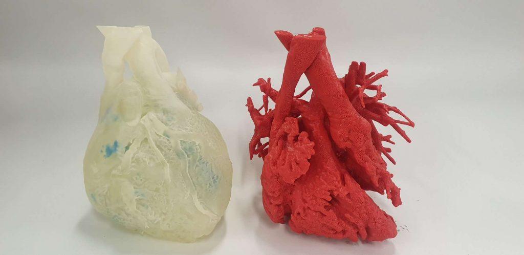 3D Lifeprints' technology has been used in a range of medical applications, including soft-printed models for simulating manipulation 3D Lifeprints' technology has been used in a range of medical applications, including soft-printed models for simulating manipulation