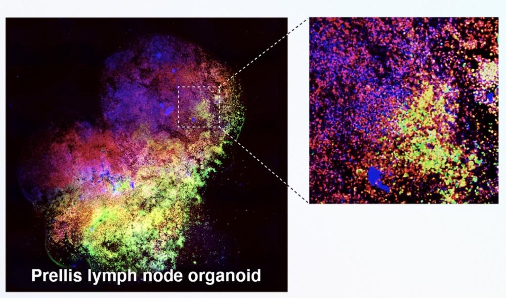 Prellis Biologics' 3D bioprinted high-resolution images of the externalized immune system Prellis Biologics' 3D bioprinted high-resolution images of the externalized immune system