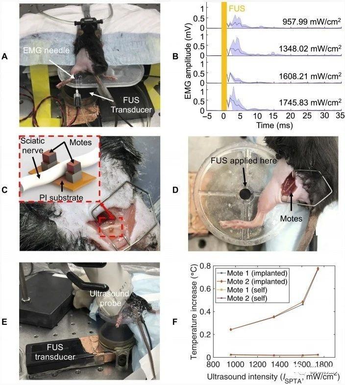 [Breakthrough]The world&#8217;s smallest implantable single-chip system, realizing wireless body temperature monitoring and other functions