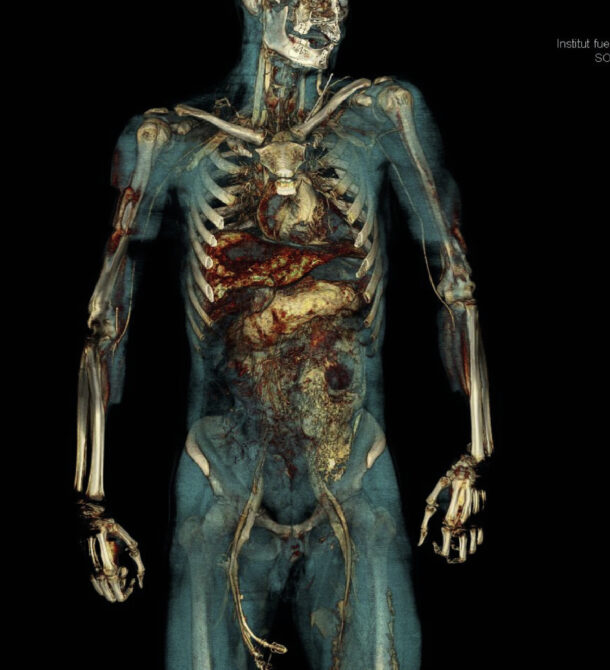 PMCTA of whole body showing contrasting blood vessels and organs PMCTA of whole body showing contrasting blood vessels and organs