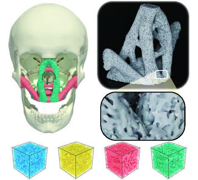 Bio-inspired 3D printed facial implants Bio-inspired 3D printed facial implants